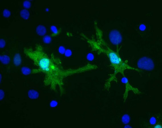 LGALS3 / Galectin 3 Antibody - Rat brain neural cultures stained with LGALS3 / Galectin 3 Antibody (green) and DNA (blue). Staining can be seen in several types of glia and lymphocytic cells, including these cells which have the morphology of microglia. Surrounding cells reveal no Galectin-3 staining.