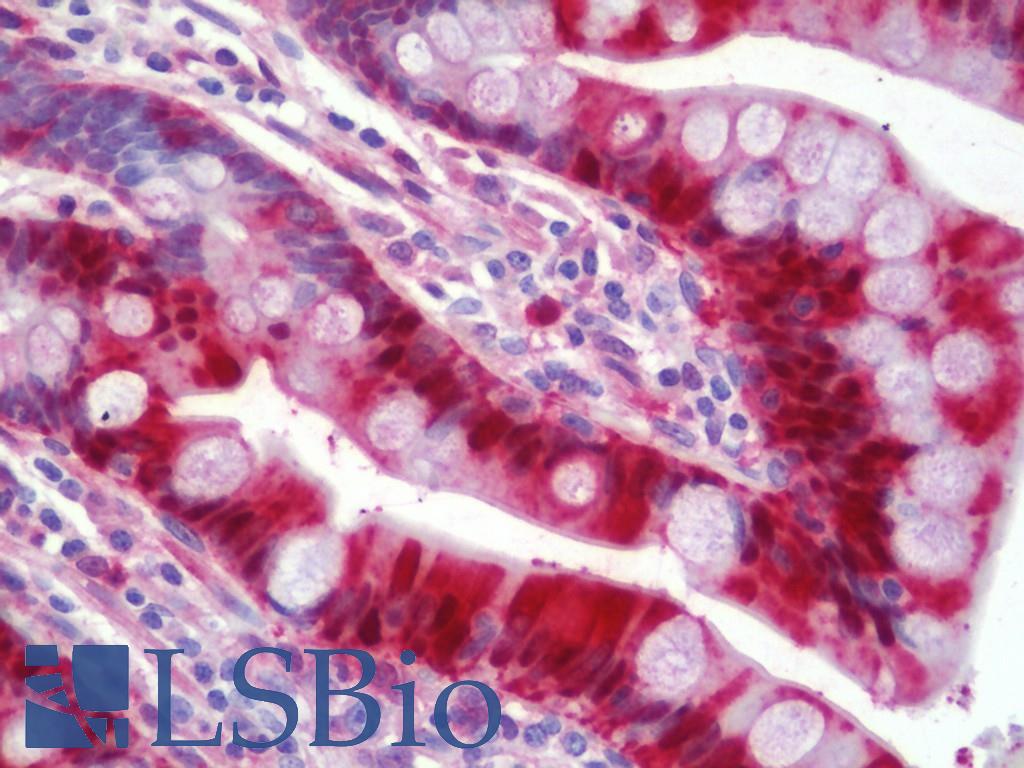 LGALS3 / Galectin 3 Antibody - Human Small Intestine: Formalin-Fixed, Paraffin-Embedded (FFPE)