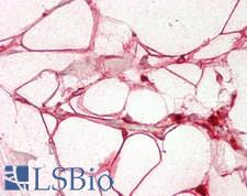 LGALS3 / Galectin 3 Antibody - Human Breast, Adipocytes: Formalin-Fixed, Paraffin-Embedded (FFPE)