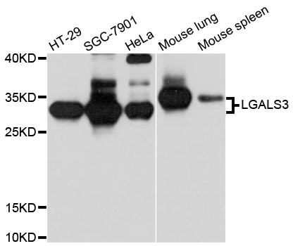 LGALS3 / Galectin 3 Antibody - Western blot analysis of extracts of various cell lines.