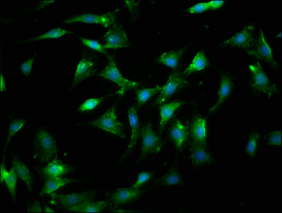 LGALS9 / Galectin 9 Antibody - Immunofluorescence staining of NIH/3T3 cells with LGALS9 Antibody at 1:100, counter-stained with DAPI. The cells were fixed in 4% formaldehyde, permeabilized using 0.2% Triton X-100 and blocked in 10% normal Goat Serum. The cells were then incubated with the antibody overnight at 4°C. The secondary antibody was Alexa Fluor 488-congugated AffiniPure Goat Anti-Rabbit IgG(H+L).