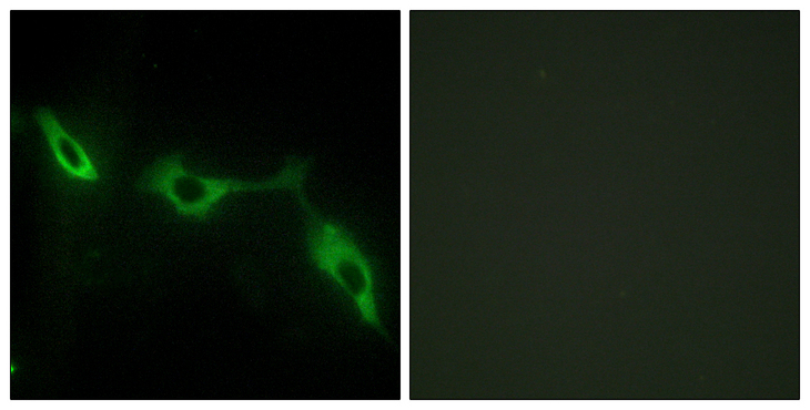 LGALS9 / Galectin 9 Antibody - Immunofluorescence analysis of NIH/3T3 cells, using LEG9 Antibody. The picture on the right is blocked with the synthesized peptide.
