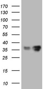 LGALS9 / Galectin 9 Antibody - HEK293T cells were transfected with the pCMV6-ENTRY control (Left lane) or pCMV6-ENTRY LGALS9 (Right lane) cDNA for 48 hrs and lysed. Equivalent amounts of cell lysates (5 ug per lane) were separated by SDS-PAGE and immunoblotted with anti-LGALS9.