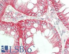 LGALS9 / Galectin 9 Antibody - Human Colon: Formalin-Fixed, Paraffin-Embedded (FFPE)