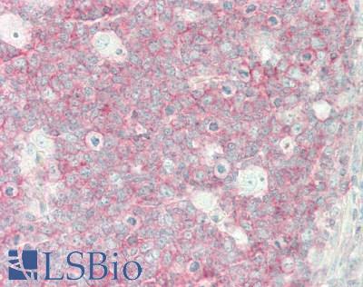 LGALS9 / Galectin 9 Antibody - Human Tonsil: Formalin-Fixed, Paraffin-Embedded (FFPE)