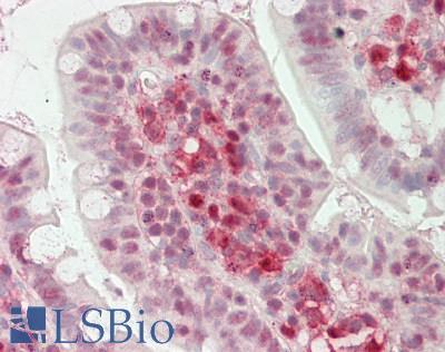 LGALS9 / Galectin 9 Antibody - Human Small Intestine: Formalin-Fixed, Paraffin-Embedded (FFPE)