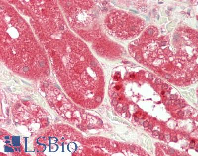 LGALS9 / Galectin 9 Antibody - Human Kidney: Formalin-Fixed, Paraffin-Embedded (FFPE)