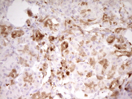 LGALS9 / Galectin 9 Antibody - IHC of paraffin-embedded Human pancreas tissue using anti-LGALS9 mouse monoclonal antibody. (Heat-induced epitope retrieval by 1 mM EDTA in 10mM Tris, pH8.5, 120°C for 3min).