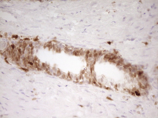 LGALS9 / Galectin 9 Antibody - IHC of paraffin-embedded Human prostate tissue using anti-LGALS9 mouse monoclonal antibody. (Heat-induced epitope retrieval by 1 mM EDTA in 10mM Tris, pH8.5, 120°C for 3min).