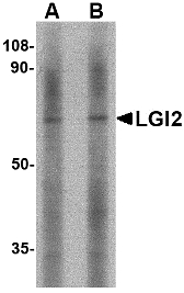 LGI2 Antibody - Western blot of LGI2 in mouse liver tissue lysate with LGI2 antibody at (A) 1 and (B) 2 ug/ml.