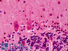 LGI2 Antibody - Anti-LGI2 antibody IHC of human brain, cerebellum. Immunohistochemistry of formalin-fixed, paraffin-embedded tissue after heat-induced antigen retrieval. Antibody concentration 5 ug/ml.