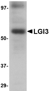 LGI3 Antibody - Western blot of LGI3 in human brain tissue lysate with LGI3 antibody at 1 ug/ml.