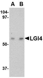 LGI4 Antibody - Western blot of LGI4 in human brain tissue lysate with LGI4 antibody at (A) 1 and (B) 2 ug/ml.