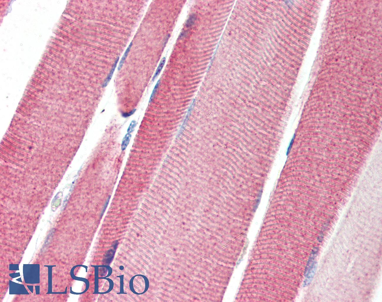 LGI4 Antibody - Anti-LGI4 antibody IHC of human skeletal muscle. Immunohistochemistry of formalin-fixed, paraffin-embedded tissue after heat-induced antigen retrieval. Antibody concentration 5 ug/ml.