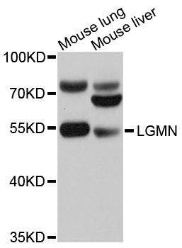 LGMN / Legumain Antibody - Western blot analysis of extracts of various cell lines, using LGMN antibody at 1:1000 dilution. The secondary antibody used was an HRP Goat Anti-Rabbit IgG (H+L) at 1:10000 dilution. Lysates were loaded 25ug per lane and 3% nonfat dry milk in TBST was used for blocking. An ECL Kit was used for detection and the exposure time was 1s.