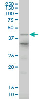 LHX4 Antibody - Western blot of LHX4 expression in human spleen with LHX4 monoclonal antibody, clone 1D6.