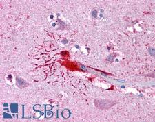 LHX8 Antibody - Anti-LHX8 antibody IHC of human brain, cortex. Immunohistochemistry of formalin-fixed, paraffin-embedded tissue after heat-induced antigen retrieval. Antibody concentration 10 ug/ml.