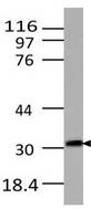 LIF Antibody - Fig-1: Western blot analysis of Mouse Lif. Anti-mLif antibody was used at 3 µg/ml on NIH3T3 lysate.
