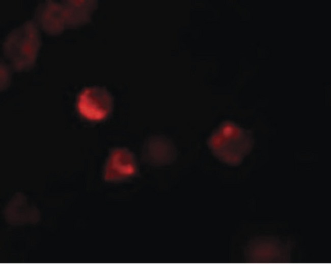 LIF Antibody - Immunofluorescence of LIF in 3T3 cells with LIF antibody at 20 ug/ml.