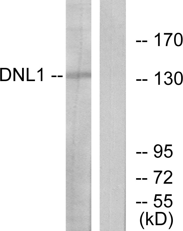 LIG1 / DNA Ligase 1 Antibody - Western blot analysis of lysates from HT-29 cells, using DNL1 Antibody. The lane on the right is blocked with the synthesized peptide.