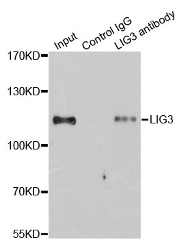 LIG3 / DNA Ligase III Antibody - Immunoprecipitation analysis of 200ug extracts of Jurkat cells.
