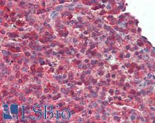 LILRB2 / ILT4 Antibody - Human Spleen: Formalin-Fixed, Paraffin-Embedded (FFPE)