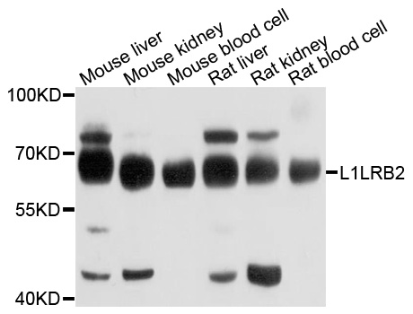 LILRB2 / ILT4 Antibody - Western blot analysis of extracts of various cell lines, using LILRB2 antibody at 1:1000 dilution. The secondary antibody used was an HRP Goat Anti-Rabbit IgG (H+L) at 1:10000 dilution. Lysates were loaded 25ug per lane and 3% nonfat dry milk in TBST was used for blocking. An ECL Kit was used for detection and the exposure time was 5s.