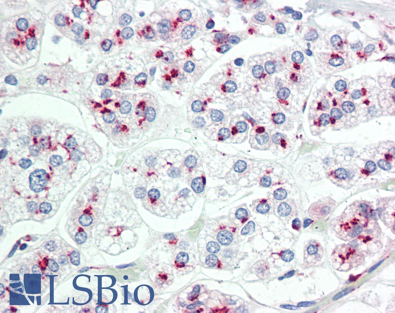 LIMD1 Antibody - Anti-LIMD1 antibody IHC staining of human adrenal. Immunohistochemistry of formalin-fixed, paraffin-embedded tissue after heat-induced antigen retrieval. Antibody dilution 1:100.