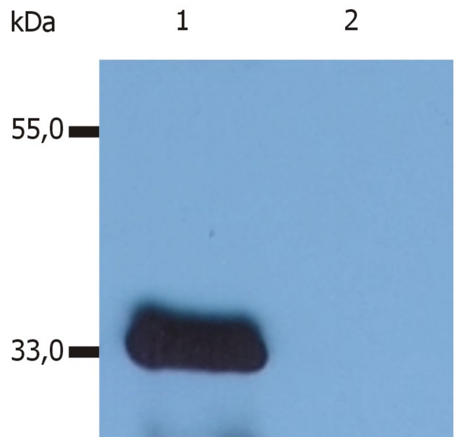 LIME1 / LIME Antibody - Western Blotting analysis (reducing conditions) of human LIME using anti-human LIME (LIME-10).  Lane 1: J77 cell line transfected with LIME  Lane 2: non-transfected J77 cell line (cells are essentialy devoid of endogenous LIME expression)