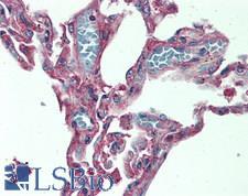 LIMK1 / LIMK Antibody - Human Lung: Formalin-Fixed, Paraffin-Embedded (FFPE)