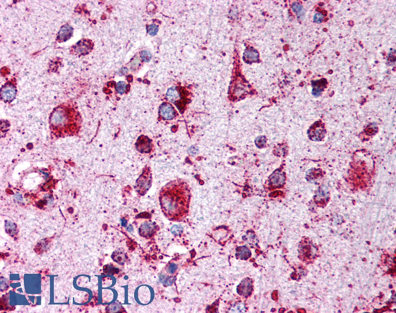 LIMPII / SCARB2 Antibody - Anti-SCARB2 antibody IHC of human brain, cortex. Immunohistochemistry of formalin-fixed, paraffin-embedded tissue after heat-induced antigen retrieval. Antibody concentration 1:500.