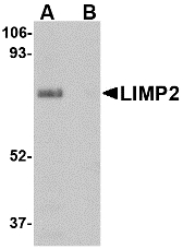 LIMPII / SCARB2 Antibody - Western blot of LIMP2 in human skeletal muscle tissue lysate with LIMP2 antibody at 1 ug/ml in (A) the absence and (B) presence of blocking peptide.