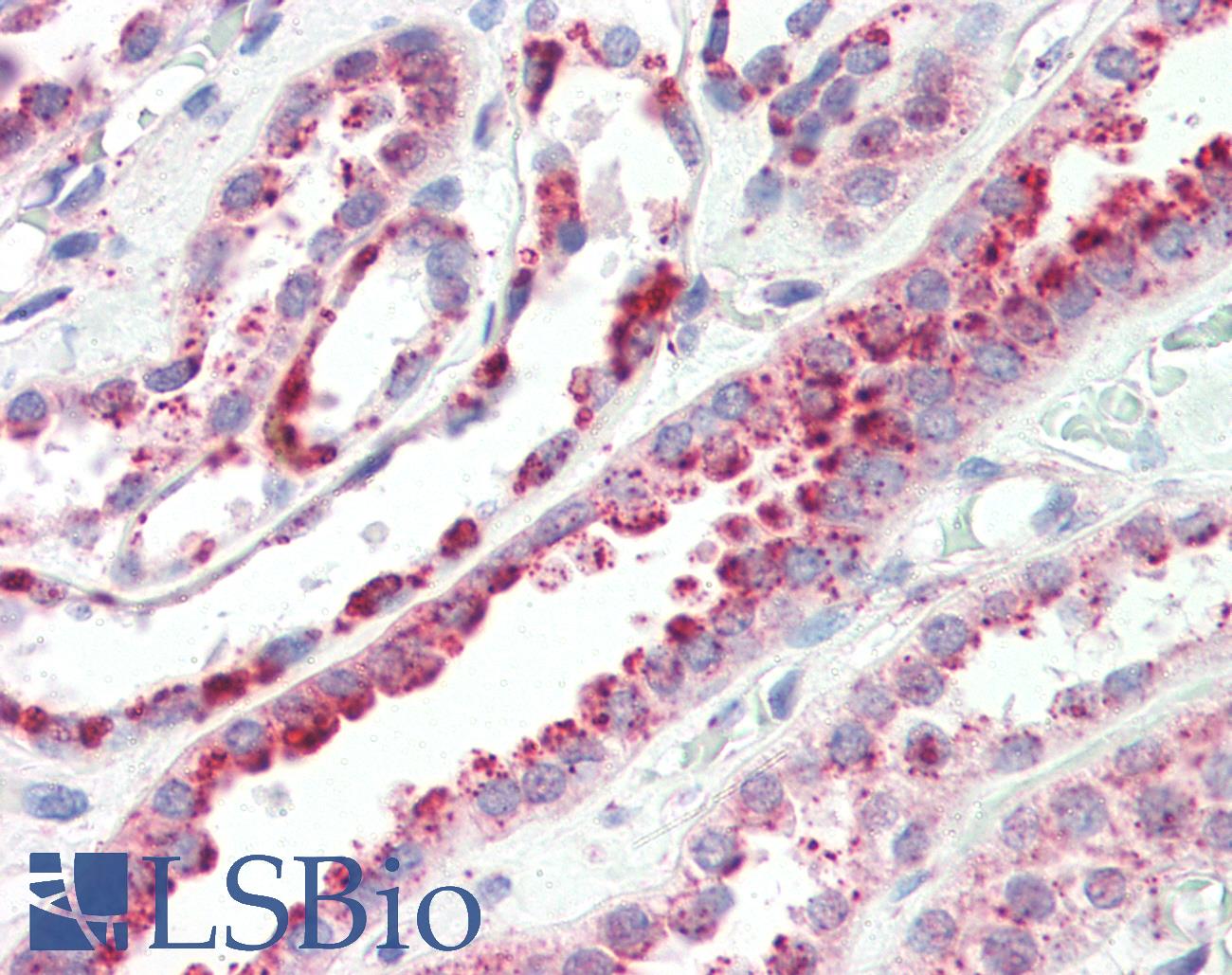 LIMPII / SCARB2 Antibody - Anti-SCARB2 antibody IHC of human kidney. Immunohistochemistry of formalin-fixed, paraffin-embedded tissue after heat-induced antigen retrieval. Antibody concentration 5 ug/ml.
