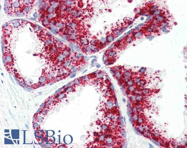 LIMPII / SCARB2 Antibody - Anti-SCARB2 antibody IHC of human prostate. Immunohistochemistry of formalin-fixed, paraffin-embedded tissue after heat-induced antigen retrieval. Antibody concentration 5 ug/ml.