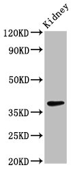 LIMS1 / PINCH Antibody - Positive Western Blot detected in Rat kidney tissue. All lanes: LIMS1 antibody at 2.7 µg/ml Secondary Goat polyclonal to rabbit IgG at 1/50000 dilution. Predicted band size: 38, 39, 45, 42 KDa. Observed band size: 38 KDa
