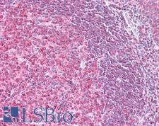 LIMS1 / PINCH Antibody - Human Tonsil: Formalin-Fixed, Paraffin-Embedded (FFPE)