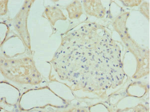 LIMS1 / PINCH Antibody - Immunohistochemistry of paraffin-embedded human kidney tissue at dilution 1:100