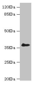 LIMS1 / PINCH Antibody - Western blot All Lanes:LIMS1 antibody at 0.93ug/ml+A549 whole cell lysate Secondary Goat polyclonal to rabbit at 1/10000 dilution Predicted band size: 38,39,45,42 kDa Observed band size: 37 kDa