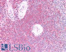 LIMS1 / PINCH Antibody - Human Spleen: Formalin-Fixed, Paraffin-Embedded (FFPE)
