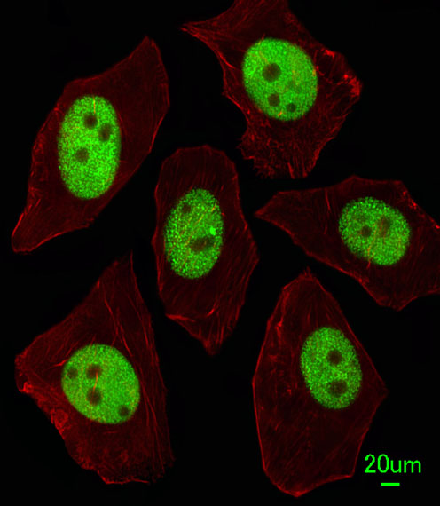 LIN28A / LIN28 Antibody - Immunofluorescence of A549 cells, using LIN28A Antibody. Antibody was diluted at 1:100 dilution. Alexa Fluor 488-conjugated goat anti-rabbit lgG at 1:400 dilution was used as the secondary antibody (green). Cytoplasmic actin was counterstained with Dylight Fluor 554 (red) conjugated Phalloidin (red).