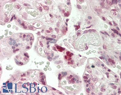 LIN28A / LIN28 Antibody - Human Placenta: Formalin-Fixed, Paraffin-Embedded (FFPE)
