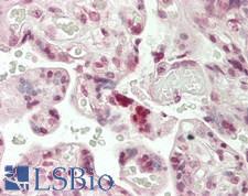LIN28A / LIN28 Antibody - Human Placenta: Formalin-Fixed, Paraffin-Embedded (FFPE)