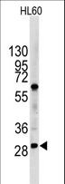 LIN28B Antibody - Western blot of LIN28B Antibody in HL60 cell line lysates (35 ug/lane). LIN28B (arrow) was detected using the purified antibody.