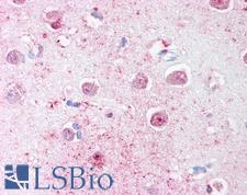 LINGO1 Antibody - Anti-LINGO1 antibody IHC of human brain, cortex. Immunohistochemistry of formalin-fixed, paraffin-embedded tissue after heat-induced antigen retrieval.