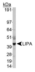 LIPA / Lysosomal Acid Lipase Antibody - Lysosomal acid lipase Antibody - WB detection of LIPA in HepG2 whole cell extract.