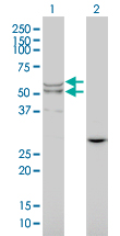 LIPA / Lysosomal Acid Lipase Antibody - Western Blot analysis of LIPA expression in transfected 293T cell line by LIPA monoclonal antibody (M01), clone 1F9.Lane 1: LIPA transfected lysate(45 KDa).Lane 2: Non-transfected lysate.
