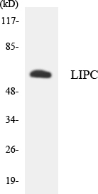 LIPC / Hepatic Lipase Antibody - Western blot analysis of the lysates from HT-29 cells using LIPC antibody.