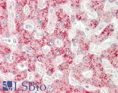 LIPC / Hepatic Lipase Antibody - Human Liver: Formalin-Fixed, Paraffin-Embedded (FFPE)