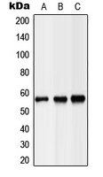LIPC / Hepatic Lipase Antibody - Western blot analysis of Hepatic Lipase expression in HEK293T (A); NIH3T3 (B); H9C2 (C) whole cell lysates.