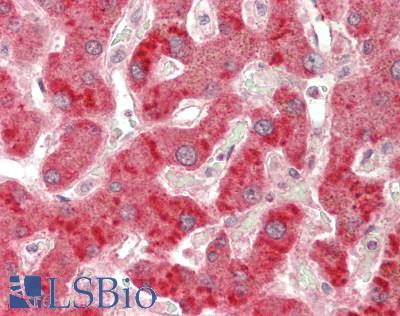 LIPC / Hepatic Lipase Antibody - Human Liver: Formalin-Fixed, Paraffin-Embedded (FFPE)